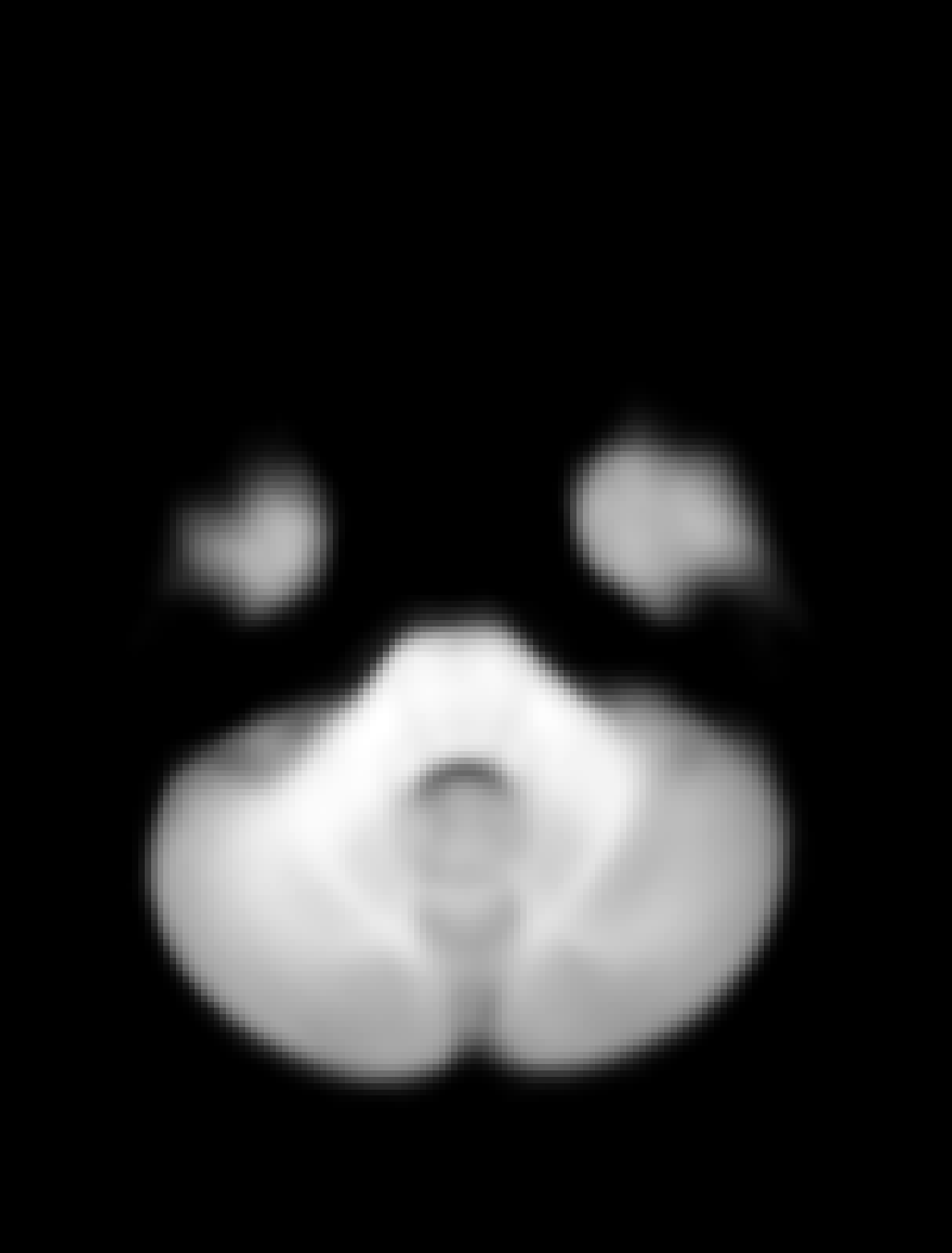 ../_images/MTR.gif