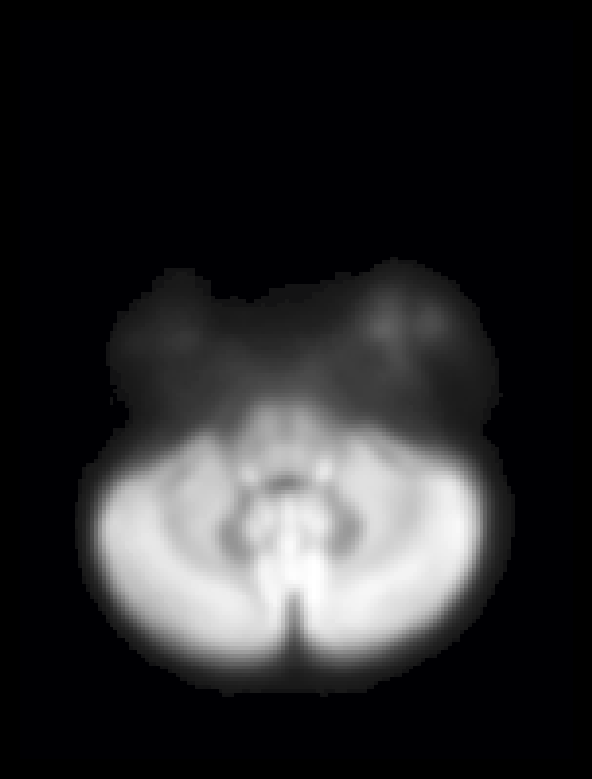 ../_images/afd_total.gif