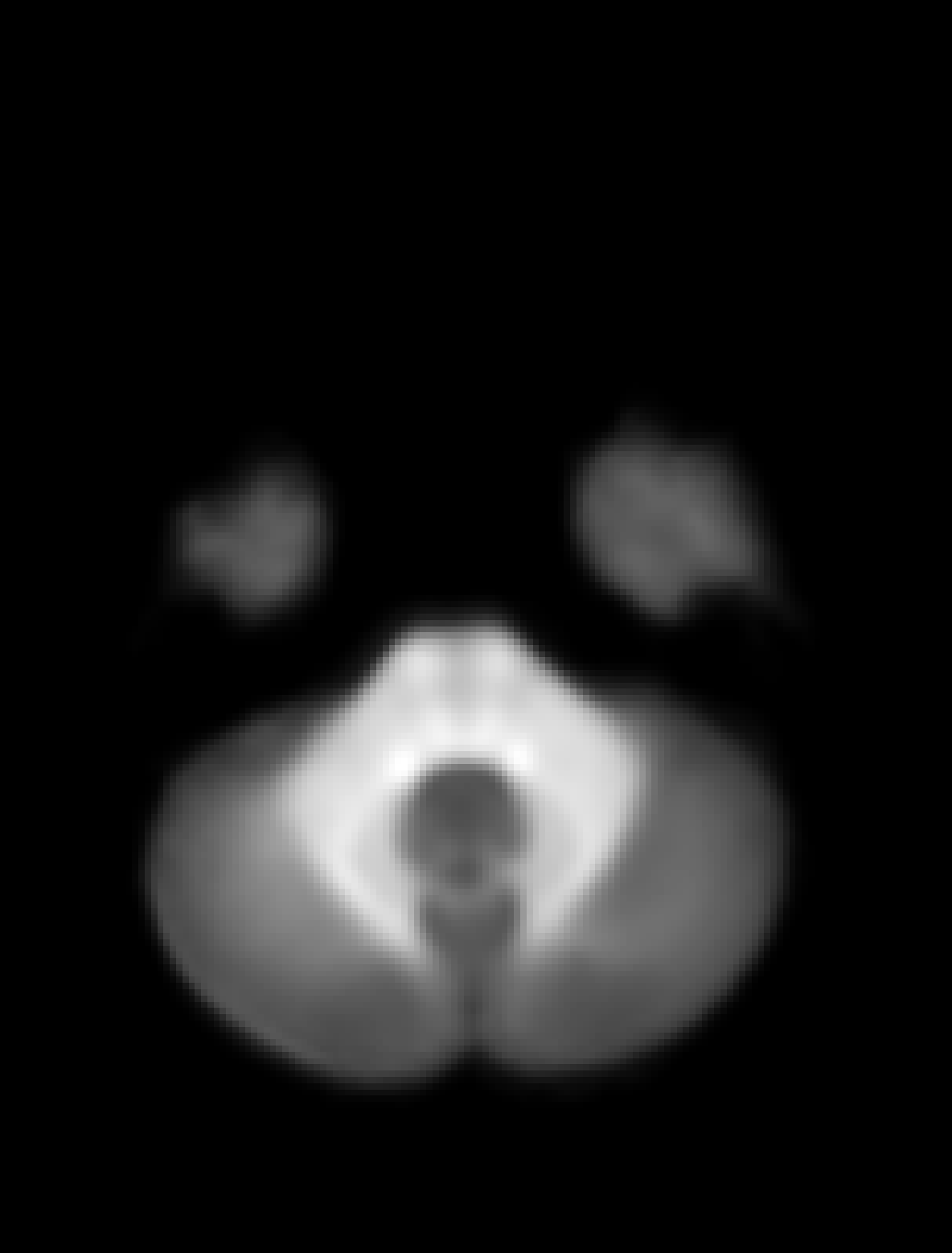 ../_images/ihMTR.gif