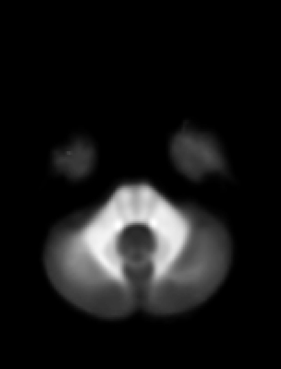 ../_images/ihMTdR1sat.gif